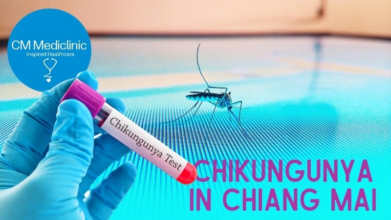 Chikungunya Test Chiang Mai