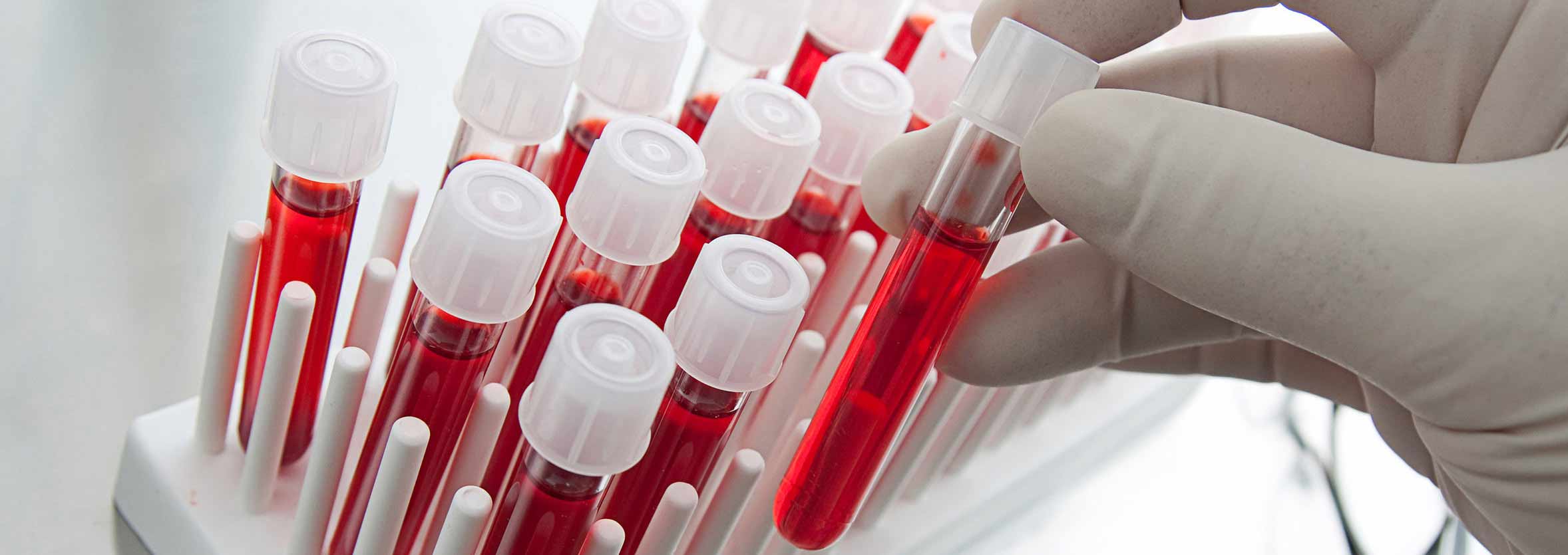 Chiang Mai Blood Test